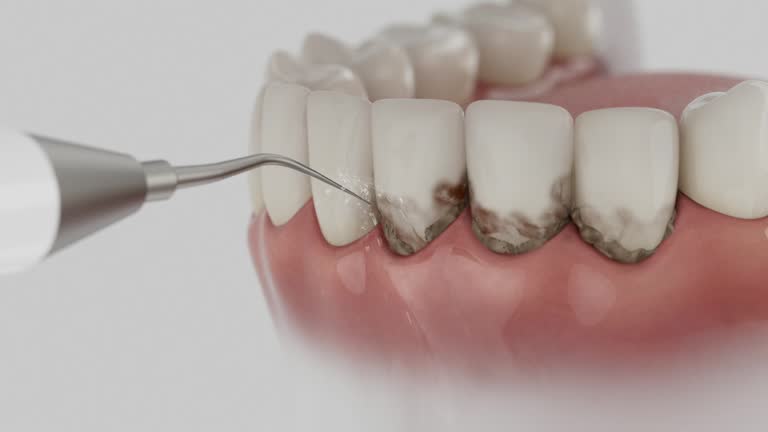 Reliable Dental Implants contractor in Chicago Heights, IL by Smile Center Dentistry